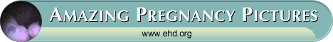 Amazing Pregnancy Pictures