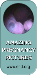 Amazing Pregnancy Pictures