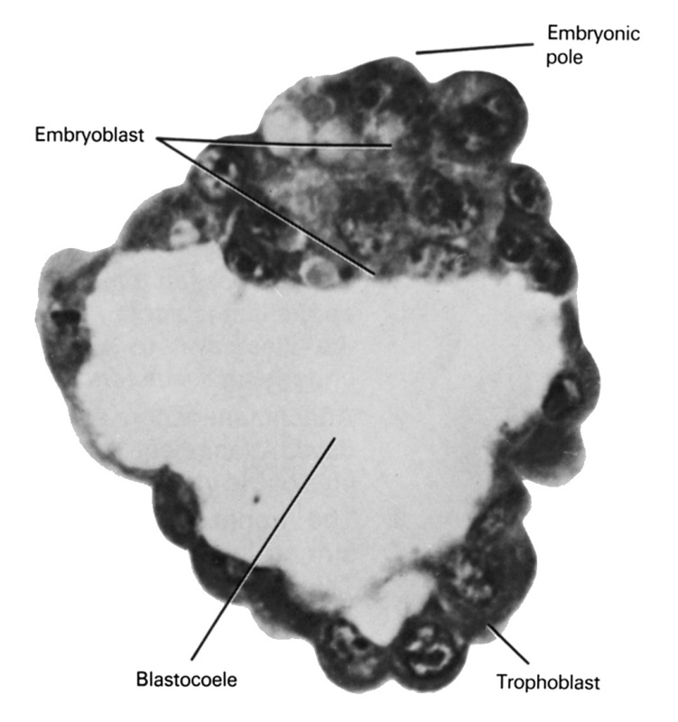 blastocystic cavity (blastocoele), embryoblast (pluriblast), embryonic pole, trophoblast