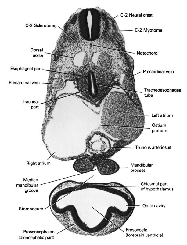 C-2 myotome, C-2 neural crest, C-2 sclerotome, chiasmal part of hypothalamus, dorsal aorta, esophageal part, left atrium, mandibular prominence of pharyngeal arch 1, median mandibular groove, notochord, optic cavity, ostium primum, precardinal vein, prosencephalon (diencephalic part), prosocoele (forebrain ventricle), right atrium, stomodeum, tracheal part, tracheo-esophageal tube, truncus arteriosus