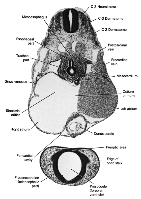 C-2 dermatome, C-3 dermatome, C-3 neural crest, conus cordis, edge of optic stalk, esophageal part, left atrium, mesocardium, mesoesophagus, ostium primum, postcardinal vein, precardinal vein, preoptic area, prosencephalon (telencephalic part), prosocoele (forebrain ventricle), right atrium, sinu-atrial orifice, sinus venosus, tracheal part