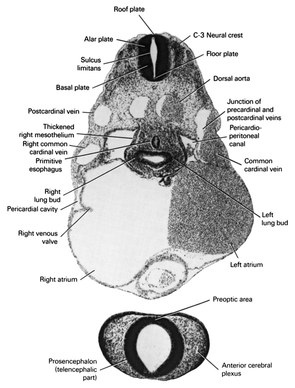 C-3 neural crest, alar plate, anterior cerebral plexus, basal plate, common cardinal vein, dorsal aorta, floor plate, junction of postcardinal and precardinal veins, left atrium, left lung bud, pericardial cavity, pericardioperitoneal canal, postcardinal vein, preoptic area, primitive esophagus, prosencephalon (telencephalic part), right atrium, right common cardinal vein, right lung bud, right venous valve, roof plate, sulcus limitans, thickened right mesothelium