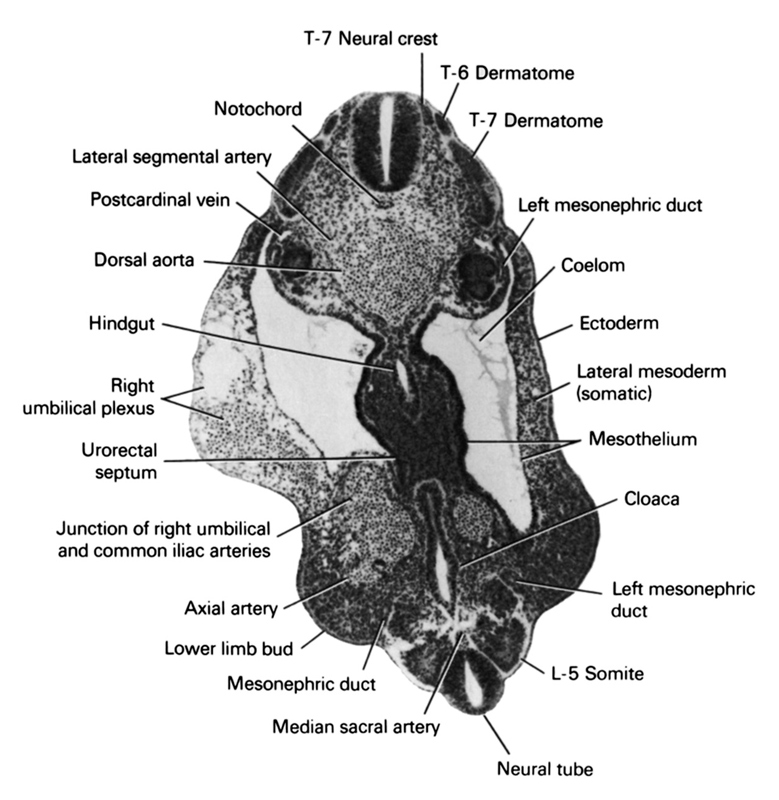 L-5 somite, T-6 dermatome, T-7 dermatome, T-7 neural crest, axial artery, cloaca, coelom, dorsal aorta, ectoderm, hindgut, junction of right umbilical and common iliac arteries, lateral mesoderm (somatic), lateral segmental artery, left mesonephric duct, lower limb bud, median sacral artery, mesonephric duct, mesothelium, neural tube, notochord, postcardinal vein, right umbilical plexus, urorectal septum