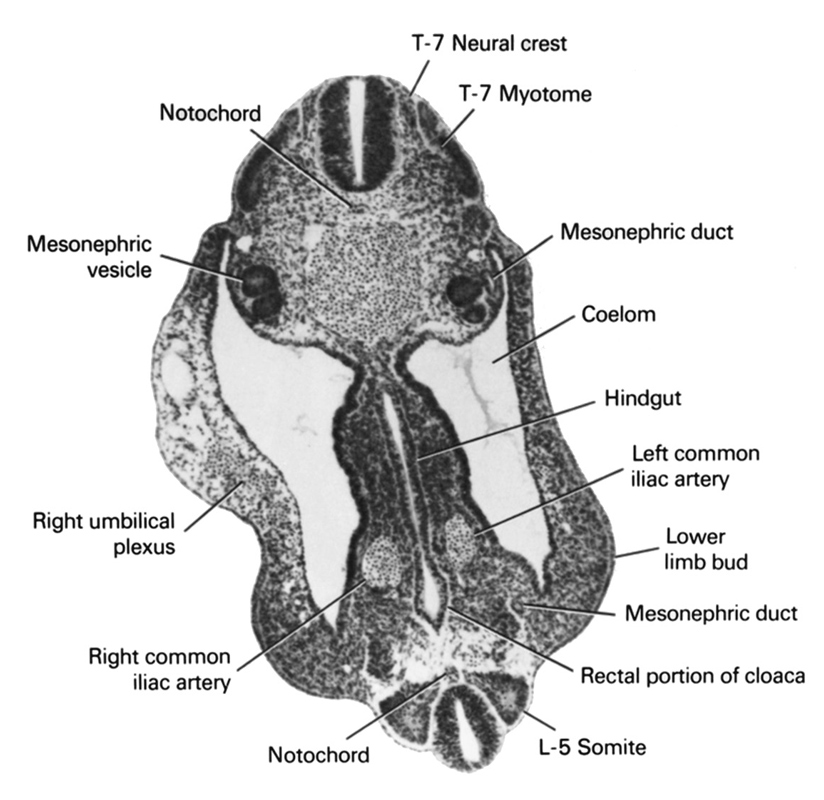 L-5 somite, T-7 myotome, T-7 neural crest, coelom, hindgut, left common iliac artery, lower limb bud, mesonephric duct, mesonephric vesicle, notochord, rectal portion of cloaca, right common iliac artery, right umbilical plexus