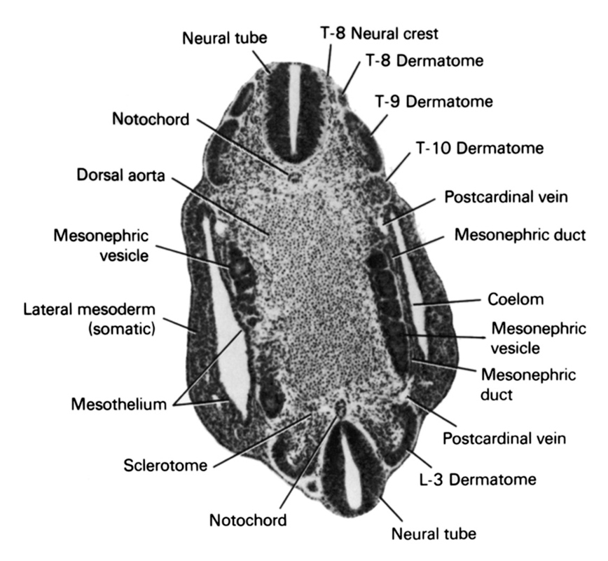 L-3 dermatome, T-10 dermatome, T-8 dermatome, T-8 neural crest, T-9 dermatome, coelom, dorsal aorta, lateral mesoderm (somatic), mesonephric duct, mesonephric vesicle, mesothelium, neural tube, notochord, postcardinal vein, sclerotome