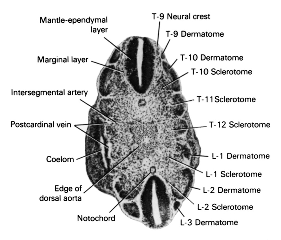 L-1 dermatome, L-1 sclerotome, L-2 dermatome, L-2 sclerotome, L-3 dermatome, T-10 dermatome, T-10 sclerotome, T-11 sclerotome, T-12 sclerotome, T-9 dermatome, T-9 neural crest, coelom, edge of dorsal aorta, intersegmental artery, mantle-ependymal layer, marginal layer, notochord, postcardinal vein
