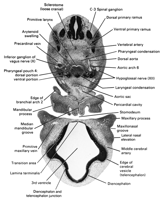 C-3 spinal ganglion, aortic arch 6, aortic sac, arytenoid swelling, diencephalon, diencoel (third ventricle), dorsal aorta, dorsal portion of pharyngeal pouch 4, dorsal primary ramus, edge of cerebral vesicle (telencephalon), edge of pharyngeal arch 2, hypoglossal nerve (CN XII), inferior ganglion of vagus nerve (CN X), junction of diencephalon and telencephalon, lamina terminalis, laryngeal condensation, lateral nasal elevation, mandibular process, maxillary process, maxillonasal groove, median mandibular groove, middle cerebral artery, pericardial cavity, pharyngeal condensation, precardinal vein, primitive larynx, primitive maxillary vein, sclerotome (loose cranial), stomodeum, transition area, ventral portion of pharyngeal pouch 4, ventral primary ramus, vertebral artery