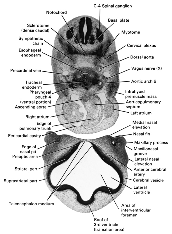 C-4 spinal ganglion, anterior cerebral artery, aortic arch 6, aorticopulmonary septum, area of interventricular foramen, ascending aorta, basal plate, cerebral vesicle, cervical plexus, dorsal aorta, edge of nasal pit, edge of pulmonary trunk, esophageal endoderm, infrahyoid premuscle mass, lateral nasal elevation, lateral ventricle, left atrium, maxillary process, maxillonasal groove, medial nasal elevation, myotome, nasal fin, notochord, pericardial cavity, pharyngeal pouch 4, pre-optic area, precardinal vein, right atrium, roof of third ventricle (transition area), sclerotome (dense caudal), striatal part, suprastriatal part, sympathetic chain, telencephalon medium, tracheal endoderm, vagus nerve (CN X)