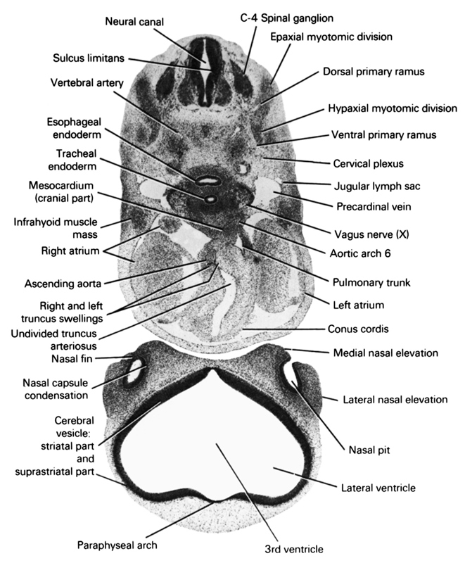 C-4 spinal ganglion, aortic arch 6, ascending aorta, cervical plexus, conus cordis, dorsal primary ramus, epaxial myotomic division, esophageal endoderm, hypaxial myotomic division, infrahyoid muscle mass, jugular lymph sac, lateral nasal elevation, lateral ventricle, left atrium, medial nasal elevation, mesocardium (cranial part), nasal capsule condensation, nasal fin, nasal pit, neural canal, paraphysial arch, precardinal vein, pulmonary trunk, right and left truncus swellings, right atrium, striatal part of cerebral vesicle, sulcus limitans, suprastriatal part of cerebral vesicle, third ventricle, tracheal endoderm, undivided truncus arteriosus, vagus nerve (CN X), ventral primary ramus, vertebral artery