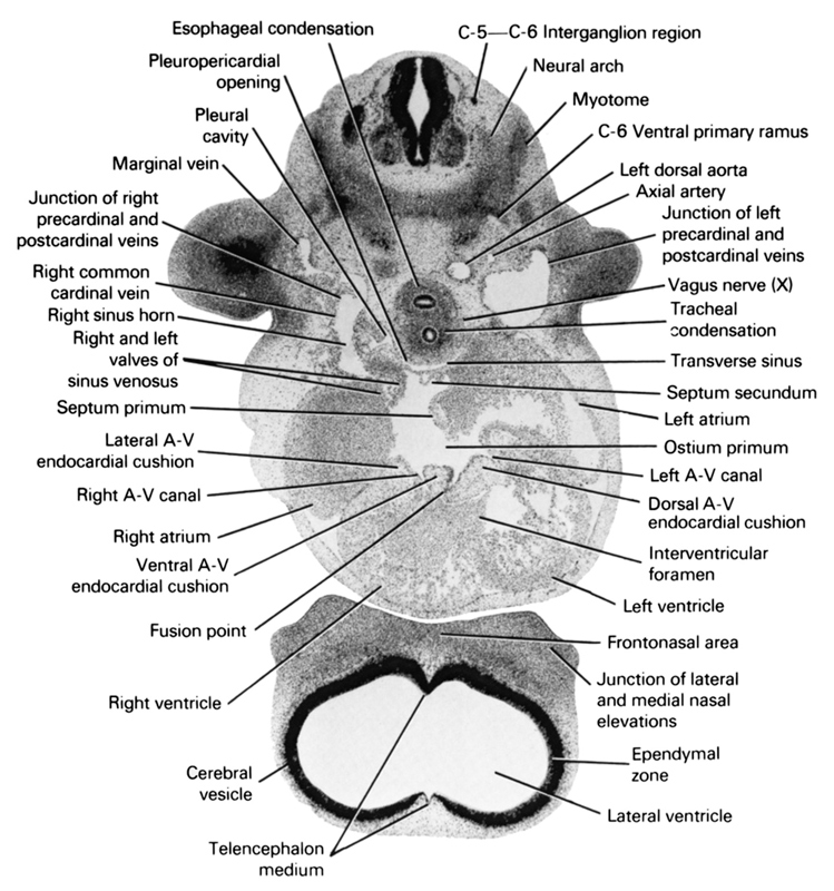 C-5 / C-6 interganglion region, C-6 ventral primary ramus, axial artery, cerebral vesicle, dorsal atrioventricular endocardial cushion, ependymal zone, esophageal condensation, frontonasal area, fusion point, interventricular foramen, junction of lateral and medial nasal prominences, junction of left precardinal and postcardinal veins, junction of right precardinal and postcardinal veins, lateral atrioventricular endocardial cushion, lateral ventricle, left atrioventricular canal, left atrium, left dorsal aorta, left ventricle, marginal vein, myotome, neural arch, ostium primum, pleural cavity, pleuropericardial opening, right and left valves of sinus venosus, right atrioventricular canal, right atrium, right common cardinal vein, right horn of sinus venosus, right ventricle, septum primum, septum secundum, telencephalon medium, tracheal condensation, transverse sinus, vagus nerve (CN X), ventral atrioventricular endocardial cushion