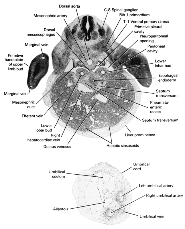 C-8 spinal ganglion, T-1 ventral primary ramus, allantois, dorsal aorta, dorsal meso-esophagus, ductus venosus, efferent vein, esophageal endoderm, hepatic sinusoids, left umbilical artery, liver prominence, lower lobar bud, marginal vein, mesonephric artery, mesonephric duct, peritoneal cavity, pleuroperitoneal opening, pneumato-enteric recess, primitive hand plate of upper limb bud, primitive pleural cavity, rib 1 primordium, right hepatocardiac vein, right umbilical artery, septum transversum, umbilical coelom, umbilical cord, umbilical vein