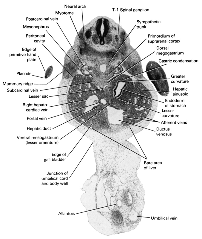 T-1 spinal ganglion, afferent veins, allantois, bare area of liver, dorsal mesogastrium, ductus venosus, edge of gall bladder, edge of primitive hand plate, endoderm of stomach, gastric condensation, greater curvature, hepatic duct(s), hepatic sinusoid, junction of umbilical cord and body wall, lesser  sac, lesser curvature, mammary ridge, mesonephros, myotome, neural arch, peritoneal cavity, placode, portal vein, postcardinal vein, primordium of suprarenal cortex, right hepatocardiac vein, subcardinal vein, sympathetic trunk, umbilical vein, ventral mesogastrium (lesser omentum)