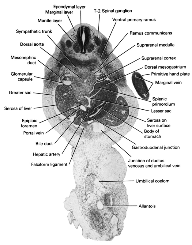 T-2 spinal ganglion, allantois, bile duct, body of stomach, dorsal aorta, dorsal mesogastrium, ependymal layer, epiploic foramen, falciform ligament, gastroduodenal junction, glomerular capsule, greater sac, hepatic artery, junction of ductus venosus and umbilical vein, lesser sac, mantle layer, marginal layer, marginal vein, mesonephric duct, portal vein, primitive hand plate, ramus communicans, serosa of liver, serosa on liver surface, splenic primordium, suprarenal cortex, suprarenal medulla, sympathetic trunk, umbilical coelom, ventral primary ramus