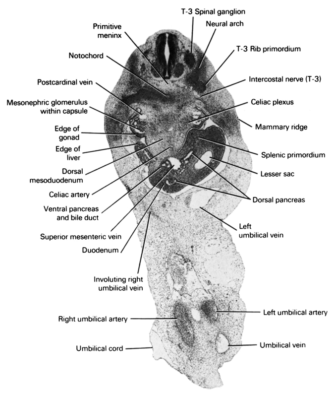 T-3 rib primordium, T-3 spinal ganglion, celiac artery, celiac plexus, dorsal mesoduodenum, dorsal pancreas, duodenum, edge of gonad, edge of liver, intercostal nerve (T-3), involuting right umbilical vein, left umbilical artery, left umbilical vein, lesser  sac, mammary ridge, mesonephric glomerulus within capsule, neural arch, notochord, postcardinal vein, primitive meninx, right umbilical artery, splenic primordium, superior mesenteric vein, umbilical cord, umbilical vein, ventral pancreas and bile duct