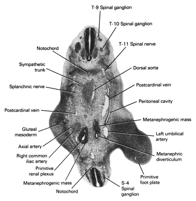 S-4 spinal ganglion, T-10 spinal ganglion, T-11 spinal nerve, T-9 spinal ganglion, axial artery, dorsal aorta, gluteal mesoderm, left umbilical artery, metanephric diverticulum, metanephrogenic mass, notochord, peritoneal cavity, postcardinal vein, primitive foot plate, primitive renal plexus, right common iliac artery, splanchnic nerve, sympathetic trunk