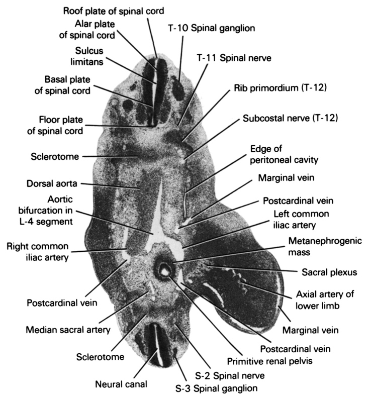 S-2 spinal nerve, S-3 spinal ganglion, T-10 spinal ganglion, T-11 spinal nerve, alar plate of spinal cord, aortic bifurcation in L-4 segment, axial artery of lower limb, basal plate of spinal cord, dorsal aorta, edge of peritoneal cavity, floor plate of spinal cord, left common iliac artery, marginal vein, median sacral artery, metanephrogenic mass, neural canal, postcardinal vein, primitive renal pelvis, rib primordium (T-12), right common iliac artery, roof plate of spinal cord, sacral plexus, sclerotome, subcostal nerve (T-12), sulcus limitans