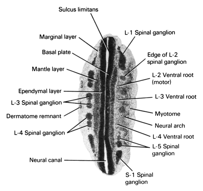 L-1 spinal ganglion, L-2 ventral root (motor), L-3 spinal ganglion, L-3 ventral root, L-4 spinal ganglion, L-4 ventral root, L-5 spinal ganglion, S-1 spinal ganglion, basal plate, dermatome remnant, edge of L-2 spinal ganglion, ependymal layer, mantle layer, marginal layer, myotome, neural arch, neural canal, sulcus limitans