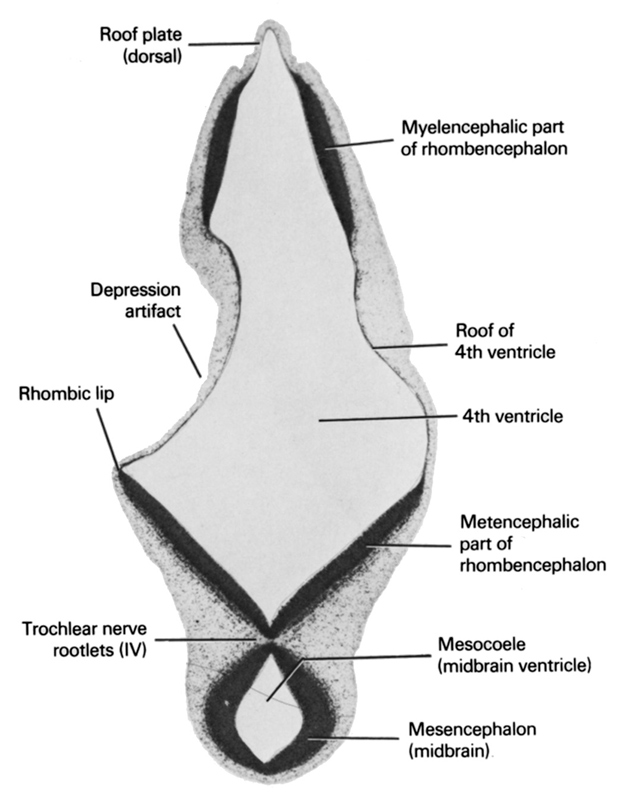 depression artifact, mesencephalon (midbrain), mesocoele (midbrain ventricle), metencephalic part of rhombencephalon, myelencephalic part of rhombencephalon, rhombencoel (fourth ventricle), rhombic lip, roof of rhombencoel (fourth ventricle), roof plate (dorsal), trochlear nerve rootlets (CN IV)