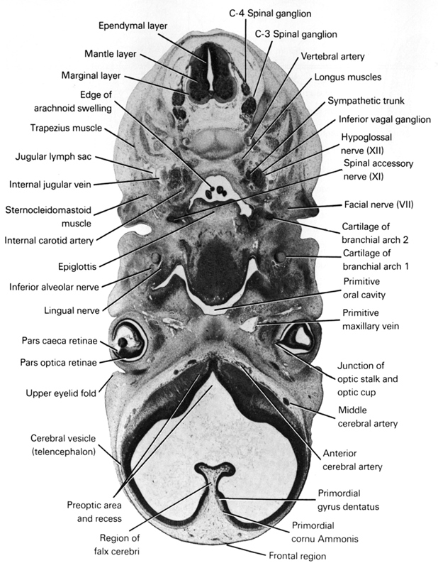 C-3 spinal ganglion, C-4 spinal ganglion, anterior cerebral artery, cartilage of branchial arch 2, cerebral vesicle (telencephalon), edge of arachnoid swelling, ependymal layer, epiglottis, facial nerve (CN VII), falx cerebri region, frontal region, hypoglossal nerve (CN XII), inferior alveolar nerve, inferior ganglion of vagus nerve (CN X), internal carotid artery, internal jugular vein, jugular lymph sac, junction of optic stalk and optic cup, lingual nerve, longus muscles, mantle layer, marginal layer, middle cerebral artery, pars caeca retinae, pars optica retinae, pharyngeal arch 1 cartilage (Meckel), preoptic area and recess, primitive maxillary vein, primitive oral cavity, primordial cornu Ammonis, primordial gyrus dentatus, spinal accessory nerve (CN XI), sternocleidomastoid muscle, sympathetic trunk, trapezius muscle, upper eyelid fold, vertebral artery