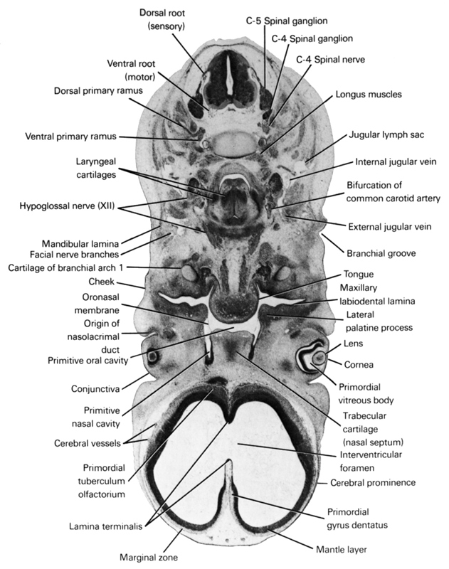 C-4 spinal ganglion, C-4 spinal nerve, C-5 spinal ganglion, bifurcation of common carotid artery, branchial groove, cerebral prominence, cerebral vessels, cheek, conjunctiva, cornea, dorsal primary ramus, dorsal root (sensory), external jugular vein, facial nerve branches, hypoglossal nerve (CN XII), internal jugular vein, interventricular foramen, jugular lymph sac, lamina terminalis, laryngeal cartilages, lateral palatine process, lens, longus muscles, mandibular lamina, mantle layer, marginal zone, maxillary labiodental lamina, origin of nasolacrimal duct, oronasal membrane, pharyngeal arch 1 cartilage (Meckel), primitive nasal cavity, primitive oral cavity, primordial gyrus dentatus, primordial tuberculum olfactorium, primordial vitreous body, tongue, trabecular cartilage (nasal septum), ventral primary ramus, ventral root (motor)