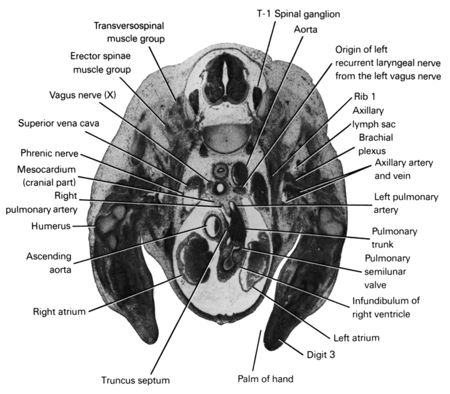 T-1 spinal ganglion, aorta, ascending aorta, axillary artery, axillary lymph sac, axillary vein, brachial plexus, digit 3, erector spinae muscle group, humerus, infundibulum of right ventricle, left atrium, left pulmonary artery, mesocardium (cranial part), origin of left recurrent laryngeal nerve from the left vagus nerve, palm of hand, phrenic nerve, pulmonary semilunar valve, pulmonary trunk, rib 1, right atrium, right pulmonary artery, superior vena cava, transversospinal muscle group, truncus septum, vagus nerve (CN X)