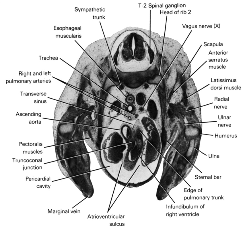 T-2 spinal ganglion, anterior serratus muscle, ascending aorta, atrioventricular sulcus, edge of pulmonary trunk, esophageal muscularis, head of rib 2, humerus, infundibulum of right ventricle, latissimus dorsi muscle, marginal vein, pectoralis muscles, pericardial cavity, radial nerve, right and left pulmonary arteries, scapula, sternal bar, sympathetic trunk, trachea, transverse sinus, truncoconal junction, ulna, ulnar nerve, vagus nerve (CN X)