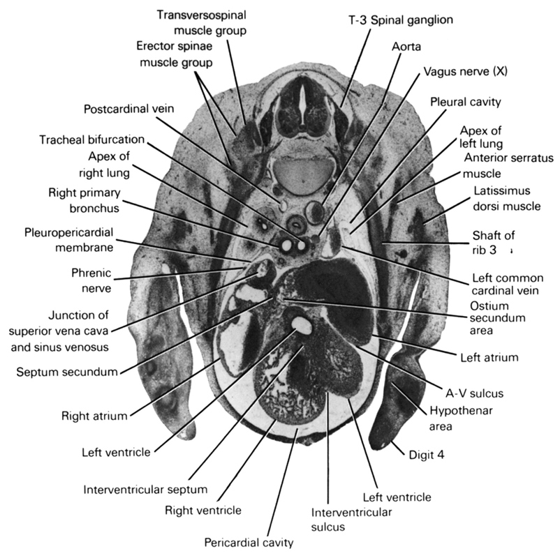 T-3 spinal ganglion, anterior serratus muscle, aorta, apex of left lung, apex of right lung, atrioventricular sulcus, digit 4, erector spinae muscle group, hypothenar area, interventricular septum, interventricular sulcus, junction of superior vena cava and sinus venosus, latissimus dorsi muscle, left atrium, left common cardinal vein, left ventricle, ostium secundum area, pericardial cavity, phrenic nerve, pleural cavity, pleuropericardial membrane, postcardinal vein, right atrium, right primary bronchus, right ventricle, septum secundum, shaft of rib 3, tracheal bifurcation, transversospinal muscle group, vagus nerve (CN X)