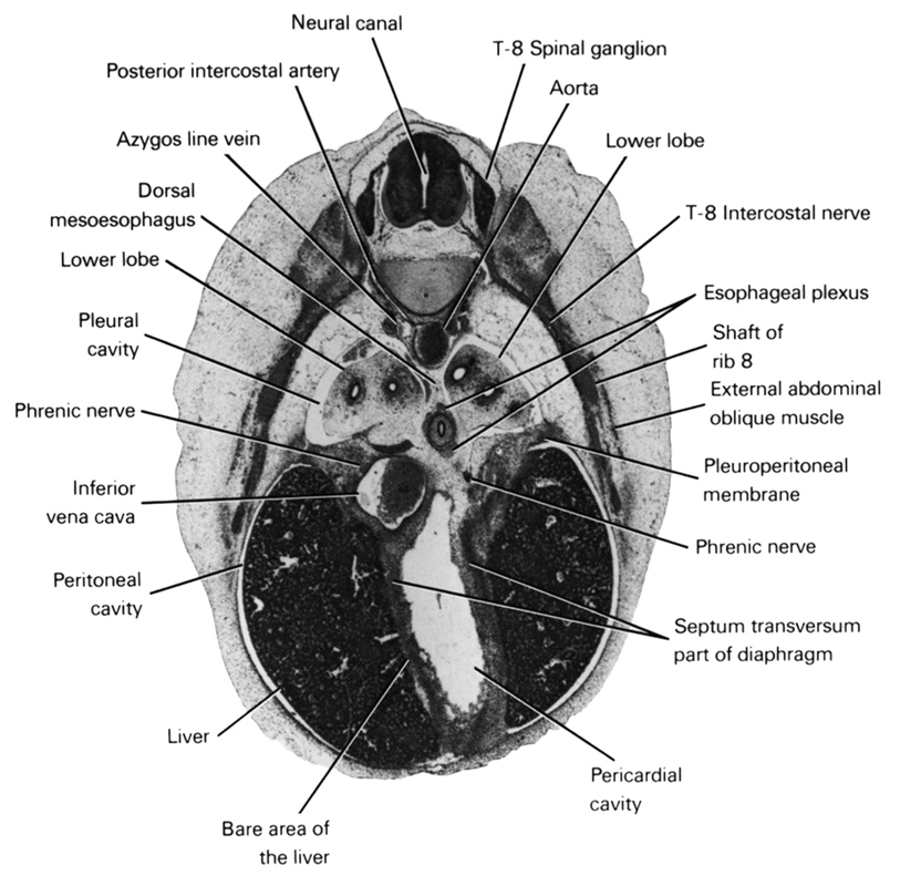T-8 intercostal nerve, T-8 spinal ganglion, aorta, azygos vein, bare area of the liver, dorsal meso-esophagus, esophageal plexus, external abdominal oblique muscle, inferior vena cava, liver, lower lobe, neural canal, pericardial cavity, peritoneal cavity, phrenic nerve, pleural cavity, pleuroperitoneal membrane, posterior intercostal artery, septum transversum, shaft of rib 8