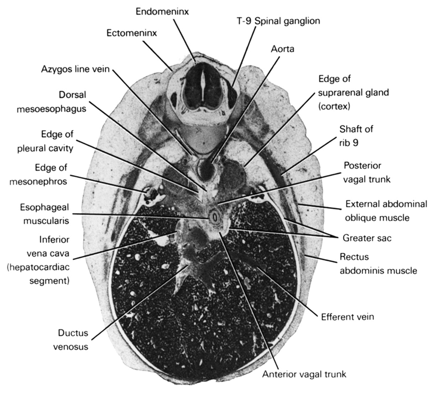 T-9 spinal ganglion, anterior vagal trunk, aorta, azygos vein, dorsal meso-esophagus, ductus venosus, ectomeninx, edge of mesonephros, edge of pleural cavity, edge of suprarenal gland (cortex), efferent vein, endomeninx, esophageal muscularis, external abdominal oblique muscle, greater sac, inferior vena cava (hepatocardiac segment), posterior vagal trunk, rectus abdominis muscle, shaft of rib 9