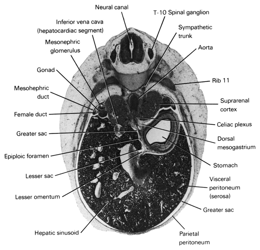 T-10 spinal ganglion, aorta, celiac plexus, dorsal mesogastrium, epiploic foramen, female duct, gonad, greater sac, hepatic sinusoid, inferior vena cava (hepatocardiac segment), lesser  sac, lesser omentum, mesonephric duct, mesonephric glomerulus, neural canal, parietal peritoneum, rib 11, stomach, suprarenal cortex, sympathetic trunk, visceral peritoneum (serosa)