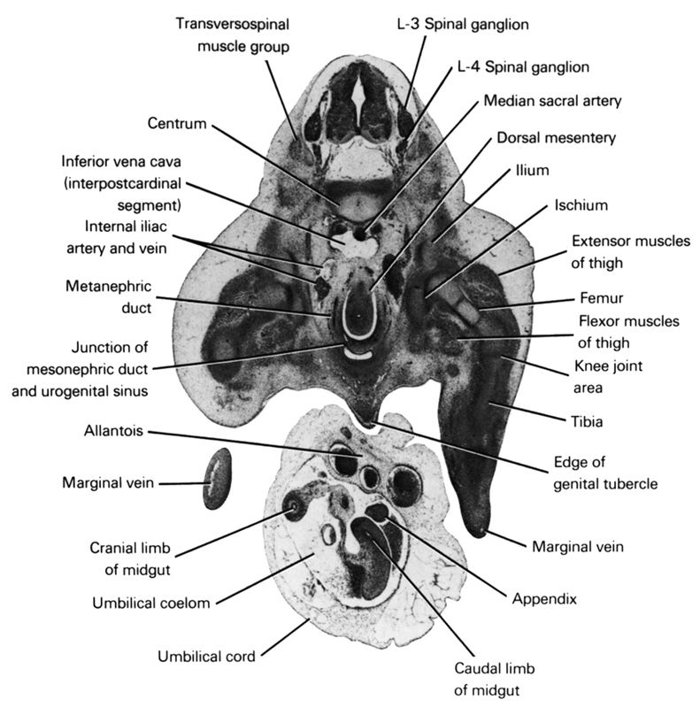 L-3 spinal ganglion, L-4 spinal ganglion, allantois, appendix, caudal limb of midgut, centrum, cranial limb of midgut, dorsal mesentery, edge of genital tubercle, extensor muscles of thigh, femur, flexor muscles of thigh, ilium, inferior vena cava (interpostcardinal segment), internal iliac artery and vein, ischium, junction of mesonephric duct and urogenital sinus, knee joint area, marginal vein, median sacral artery, metanephric duct, tibia, transversopinal muscle group, umbilical coelom, umbilical cord