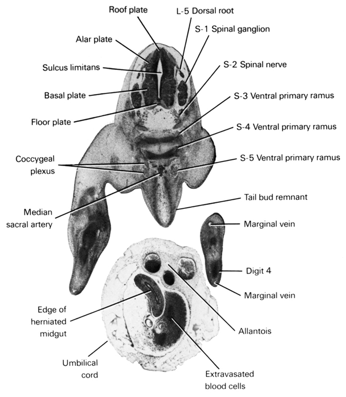 L-5 dorsal root, S-1 spinal ganglion, S-2 spinal nerve, S-3 ventral primary ramus, S-4 ventral primary ramus, S-5 ventral primary ramus, alar plate(s), allantois, basal plate, coccygeal plexus, digit 4, edge of herniated midgut, extravasated blood cells, floor plate, marginal vein, median sacral artery, roof plate, sulcus limitans, tail bud remnant, umbilical cord