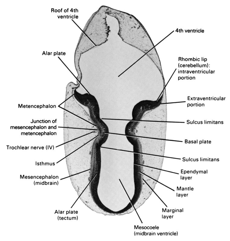 alar plate (tectum), alar plate(s), basal plate, ependymal layer, extraventricular portion, isthmus, junction of mesencephalon and metencephalon, mantle layer, marginal layer, mesencephalon (midbrain), mesocoele (midbrain ventricle), metencephalon, rhombencoel (fourth ventricle), rhombic lip (cerebellum): intraventricular portion, roof of rhombencoel (fourth ventricle), sulcus limitans, trochlear nerve (CN IV)