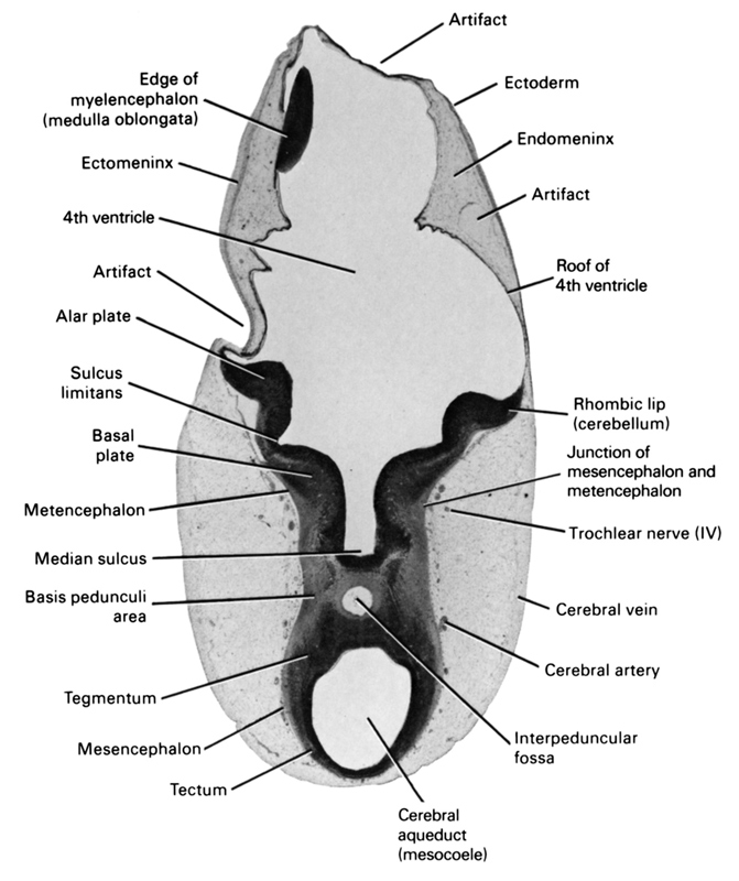 alar plate(s), artifact(s), basal plate, basis pedunculi area, cerebral aqueduct (mesocoele), cerebral artery, cerebral vein, ectoderm, ectomeninx, edge of myelencephalon (medulla oblongata), endomeninx, interpeduncular fossa, junction of mesencephalon and metencephalon, median sulcus, mesencephalon, metencephalon, rhombencoel (fourth ventricle), rhombic lip (cerebellum), roof of rhombencoel (fourth ventricle), sulcus limitans, tectum, tegmentum, trochlear nerve (CN IV)