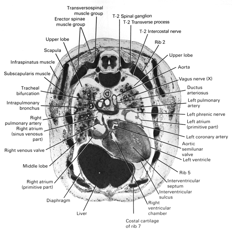 T-2 intercostal nerve, T-2 spinal ganglion, aorta, aortic semilunar valve, diaphragm, ductus arteriosus, erector spinae muscle group, infraspinatus muscle, interventricular septum, interventricular sulcus, intrapulmonary bronchus, left atrium (primitive part), left coronary artery, left phrenic nerve, left pulmonary artery, left ventricle, liver, middle lobe of right lung, rib 2, rib 5, rib 7 (costal cartilage), right atrium (primitive part), right atrium (sinus venosus part), right pulmonary artery, right venous valve, right ventricular chamber, scapula, subscapularis muscle, tracheal bifurcation, transversospinal muscle group, tranverse process of T-2 vertebrae, upper lobe of left lung, upper lobe of right lung, vagus nerve (CN X)