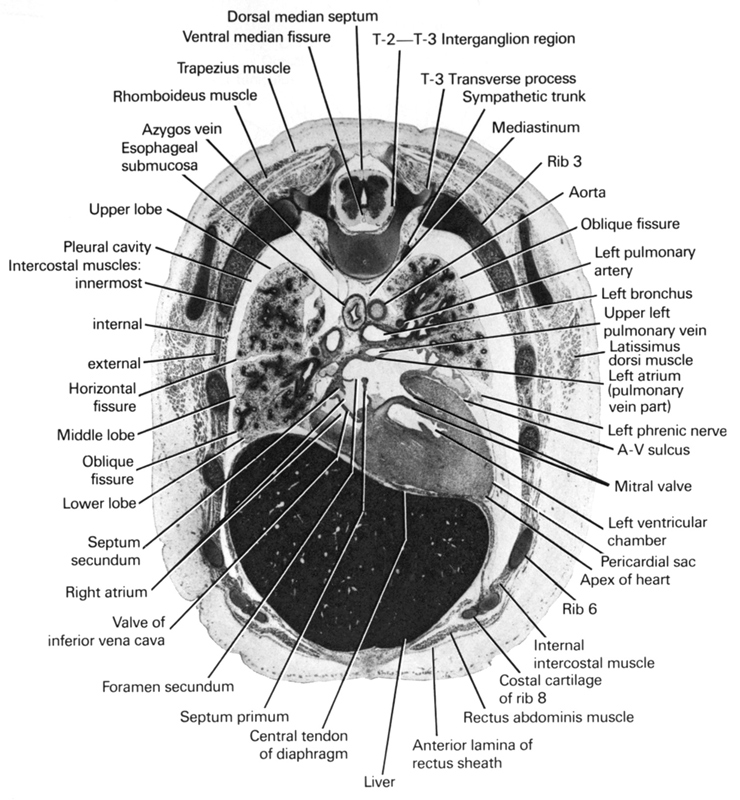 T-2 / T-3 interganglion region, anterior lamina of rectus sheath, aorta, apex of heart, atrio-ventricular sulcus, azygos vein, central tendon of diaphragm, dorsal median septum, esophageal submucosa, external intercostal muscle(s), horizontal fissure, innermost intercostal muscle(s), internal intercostal muscle(s), latissimus dorsi muscle, left atrioventricular (mitral) valve, left atrium (pulmonary vein part), left bronchus, left phrenic nerve, left pulmonary artery, left upper pulmonary vein, left ventricular chamber, liver, lower lobe of right lung, mediastinum, middle lobe of right lung, oblique fissure, pericardial sac, pleural cavity, primary interatrial septum (septum primum), rectus abdominis muscle, rhomboideus muscle, rib 3, rib 6, rib 8 (costal cartilage), right atrium, secondary interatrial foramen (foramen secundum), secondary interatrial septum (septum secundum), sympathetic trunk, transverse process of T-3 vertebra, trapezius muscle, upper lobe of right lung, valve of inferior vena cava, ventral median fissure