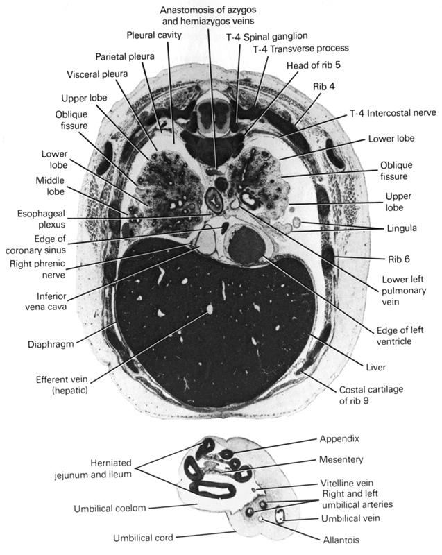 T-4 intercostal nerve, T-4 spinal ganglion, T-4 transverse process, allantois, anastomosis between azygos and hemi-azygos veins, appendix, costal cartilage of rib 9, diaphragm, edge of coronary sinus, edge of left ventricle, efferent vein (hepatic), esophageal nerve plexus, head of rib 5, herniated jejunum and ileum, inferior vena cava, lingula, liver, lower left pulmonary vein, lower lobe of left lung, lower lobe of right lung, mesentery, middle lobe of right lung, oblique fissure, parietal pleura, pleural cavity, rib 4, rib 6, right and left umbilical arteries, right phrenic nerve, umbilical coelom, umbilical cord, umbilical vein, upper lobe of left lung, upper lobe of right lung, visceral pleura, vitelline (omphalomesenteric) vein