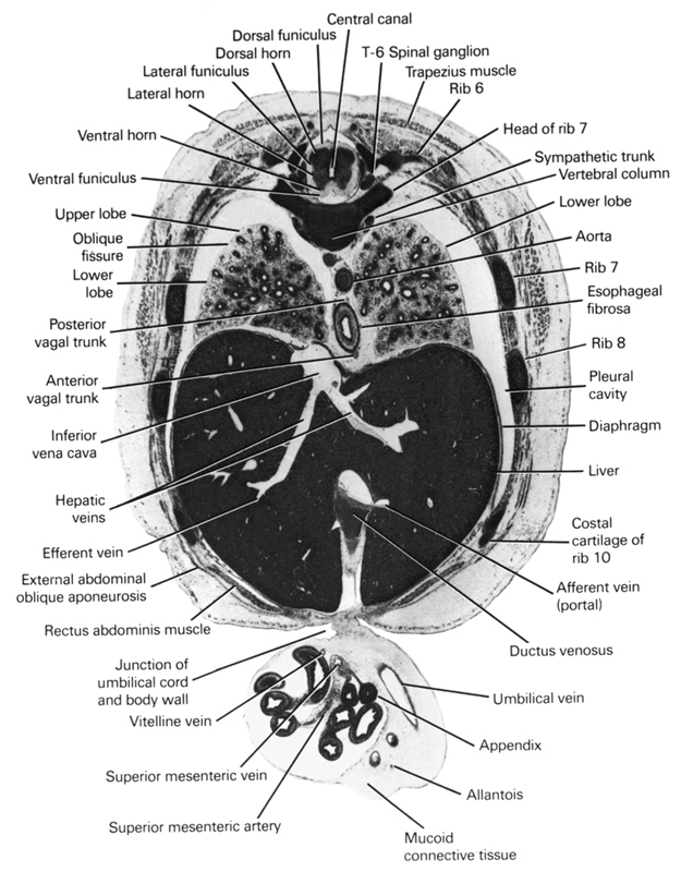 T-6 spinal ganglion, afferent vein (portal), allantois, anterior vagal trunk, aorta, appendix, central canal, diaphragm, dorsal funiculus, dorsal horn, ductus venosus, efferent vein, esophageal fibrosa, external abdominal oblique aponeurosis, head of rib 7, hepatic veins, inferior vena cava, junction of abdominal wall and umbilical cord, lateral funiculus, lateral horn, liver, lower lobe of left lung, lower lobe of right lung, mucoid connective tissue, oblique fissure, pleural cavity, posterior vagal trunk, rectus abdominis muscle, rib 10 (costal cartilage), rib 6, rib 7, rib 8, superior mesenteric artery, superior mesenteric vein, sympathetic trunk, trapezius muscle, umbilical vein, upper lobe of right lung, ventral funiculus, ventral horn, vertebral column, vitelline (omphalomesenteric) vein