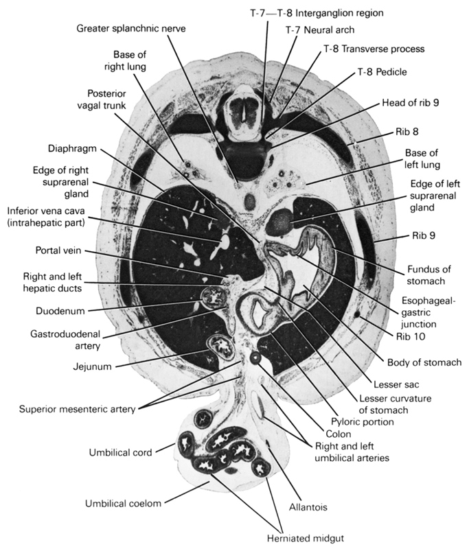 T-6 / T-7 interganglion region, T-7 neural arch, T-8 pedicle, T-8 transverse process, allantois, base of left lung, base of right lung, body of stomach, colon, diaphragm, duodenum, edge of left suprarenal gland, edge of right suprarenal gland, esophageal-gastric junction, fundus of stomach, gastroduodenal artery, greater splanchnic nerve, head of rib 9, herniated midgut, inferior vena cava (intrahepatic part), jejunum, lesser curvature of stomach, lesser sac, portal vein, posterior vagal trunk, pyloric portion, rib 10, rib 8, rib 9, right and left hepatic ducts, right and left umbilical arteries, superior mesenteric artery, umbilical coelom, umbilical cord