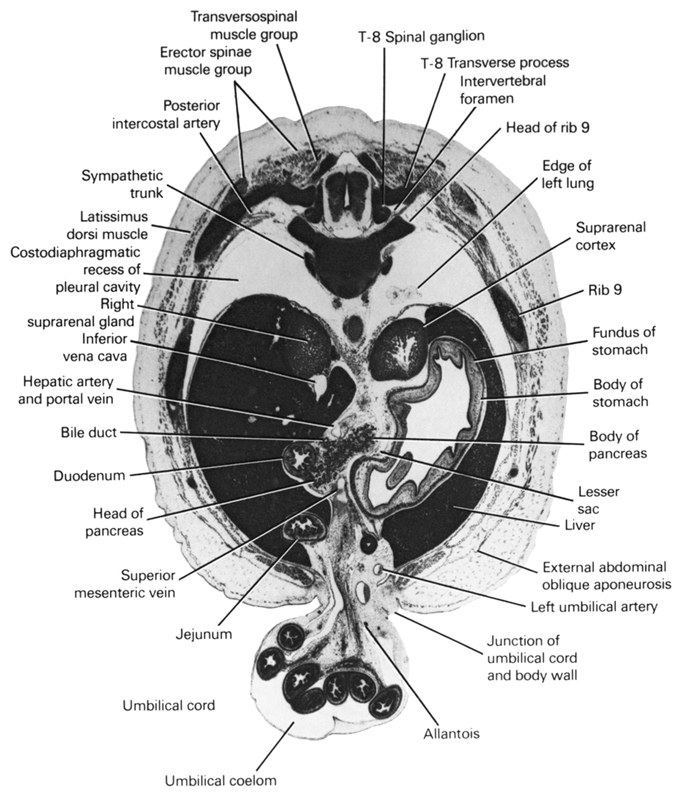 T-8 spinal ganglion, T-8 transverse process, allantois, bile duct, body of pancreas, body of stomach, costodiaphragmatic recess of pleural cavity, duodenum, edge of left lung, erector spinae muscle group, external abdominal oblique aponeurosis, fundus of stomach, head of pancreas, head of rib 9, hepatic artery and portal vein, inferior vena cava, intervertebral foramen, jejunum, junction of umbilical cord and body wall, latissimus dorsi muscle, left umbilical artery, lesser sac, liver, posterior intercostal artery, rib 9, right suprarenal gland, superior mesenteric vein, suprarenal cortex, sympathetic trunk, transversopinal muscle group, umbilical coelom, umbilical cord