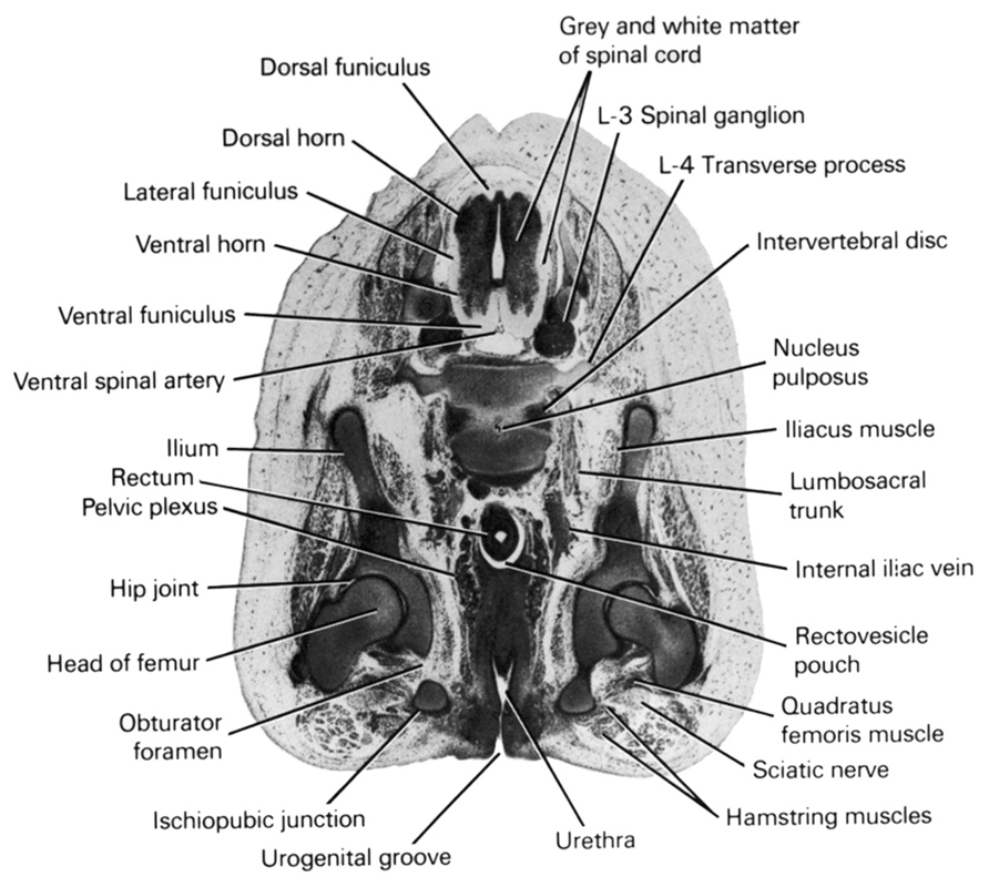 L-3 spinal ganglion, L-4 transverse process, dorsal funiculus, dorsal horn, grey and white matter of spinal cord, hamstring muscles, head of femur, hip joint, iliacus muscle, ilium, internal iliac vein, intervertebral disc, ischiopubic junction, lateral funiculus, lumbosacral trunk, nucleus pulposus, obturator foramen, pelvic plexus, quadratus femoris muscle, rectovesicle pouch, rectum, sciatic nerve, urethra, urogenital groove, ventral funiculus, ventral horn, ventral spinal artery