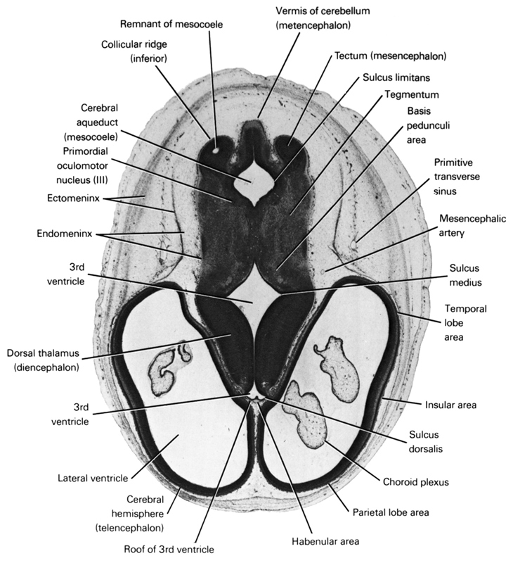 basis pedunculi area, cerebral aqueduct (mesocoel), cerebral hemisphere (telencephalon), choroid plexus, collicular ridge (inferior), dorsal thalamus (diencephalon), ectomeninx, endomeninx, habenular area, insular area, lateral ventricle, mesencephalic artery, parietal lobe area, primitive transverse sinus, primordial oculomotor nucleus, remnant of mesocoele, roof of third ventricle, sulcus dorsalis, sulcus limitans, sulcus medius, tectum of mesencephalon, tegmentum, temporal lobe area, third ventricle, vermis of cerebellum (metencephalon)