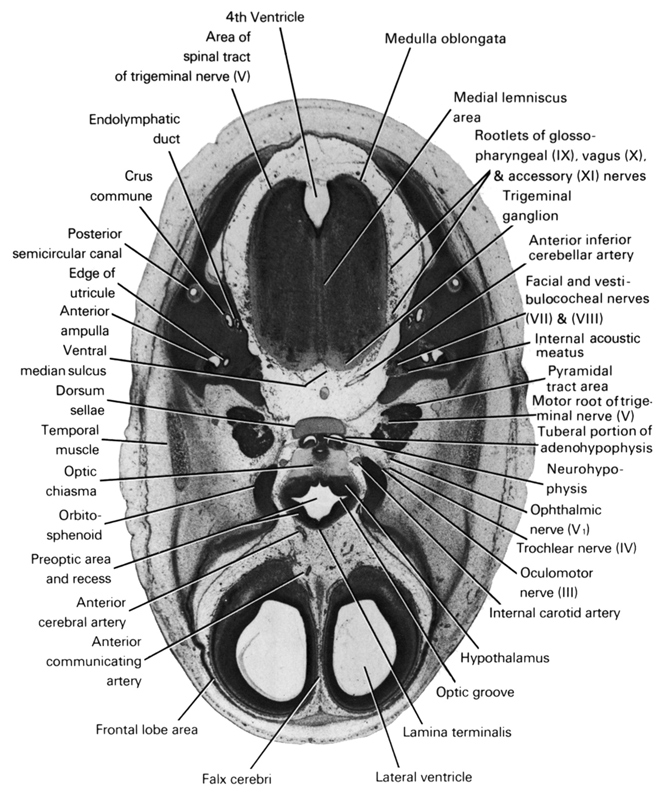 anterior ampulla, anterior cerebral artery, anterior communicating artery, anterior inferior cerebellar artery, area of spinal tract of trigeminal nerve (CN V), crus commune, dorsum sellae, edge of utricle, endolymphatic duct, facial and vestibulocochlear nerves (CN VII and CN VIII), falx cerebri, frontal lobe area, hypothalamus, internal acoustic meatus, internal carotid artery, lamina terminalis, lateral ventricle, medial lemniscus area, medulla oblongata, motor root of trigeminal nerve (CN V), neurohypophysis, oculomotor nerve (CN III), ophthalmic nerve (CN V₁), optic chiasma (chiasmatic plate), optic groove, orbitosphenoid, posterior semicircular duct, preoptic area and recess, pyramidal tract region, rhombencoel (fourth ventricle), root of accessory nerve (CN XI), root of glossopharyngeal nerve (CN IX), root of vagus nerve (CN X), temporalis muscle, trigeminal ganglion (CN V), trochlear nerve (CN IV), tuberal portion of adenohypophysis, ventral median sulcus