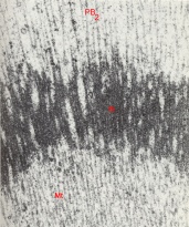 Details of the interbody region of the second meiotic spindle