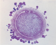 Second polar body in the subzonal space