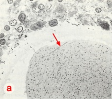 High power LM of section through the fertilization cone