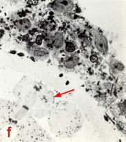 High power LM of section through the fertilization cone