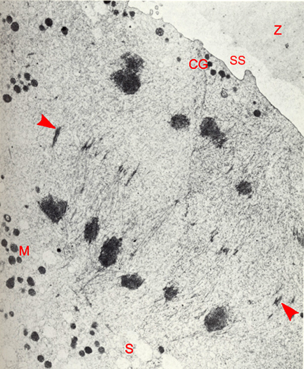 Anaphase II spindle