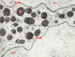 Interpronuclear zone