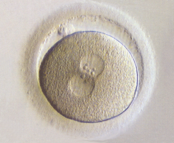 Two pronuclei of approximate equal size